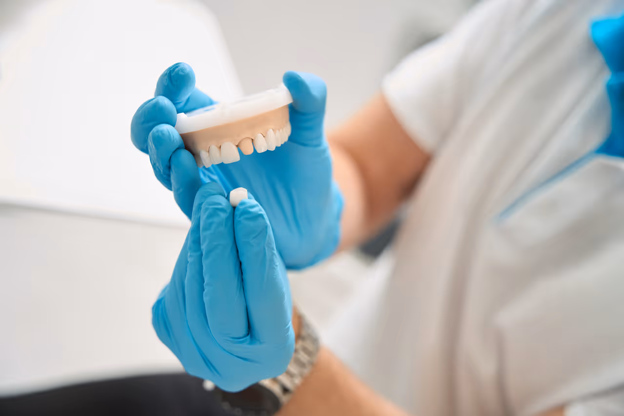 Here’s Everything You Need to Know About Dental Crown Treatment