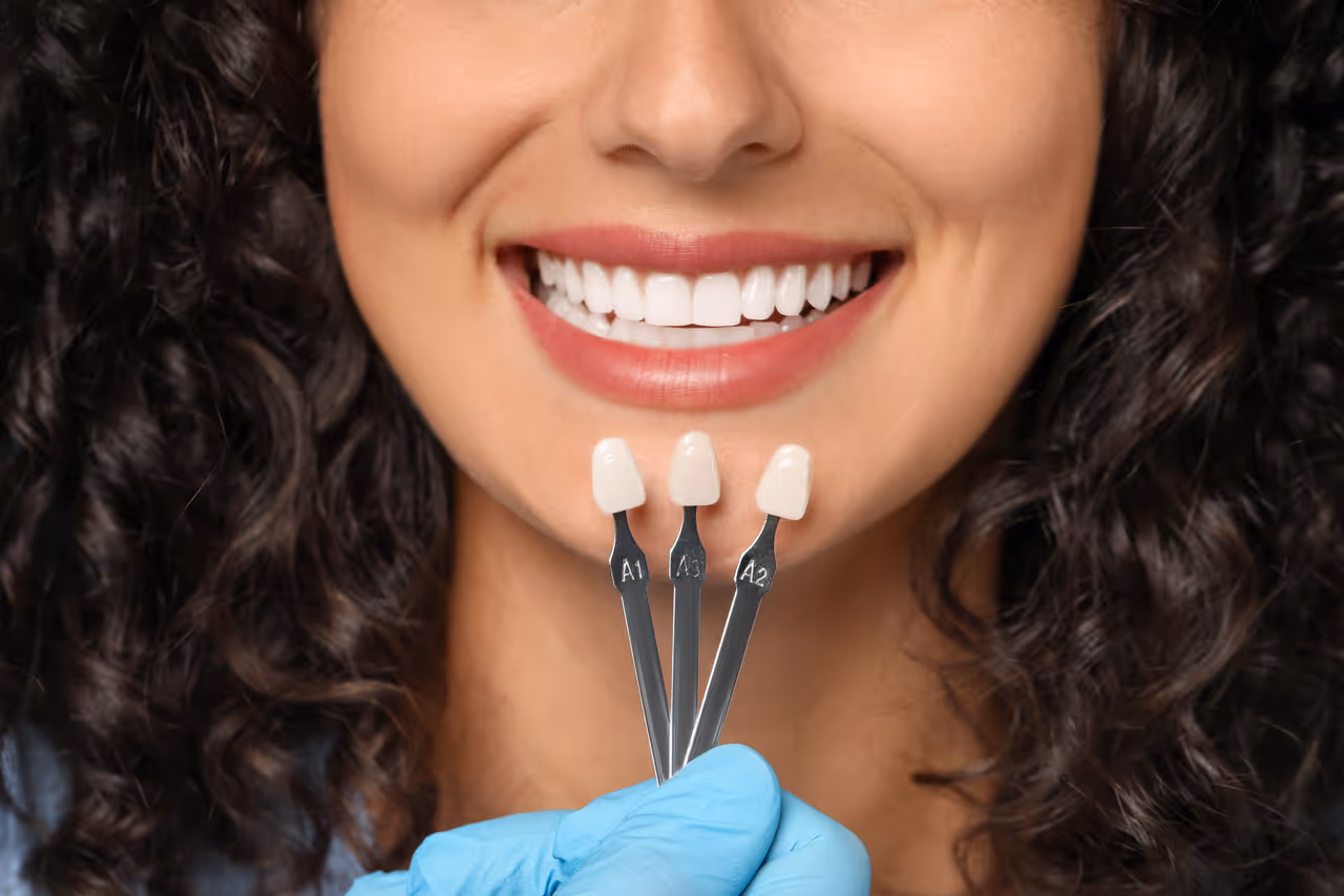 Can You Get Teeth Veneers If You Have Cavities?